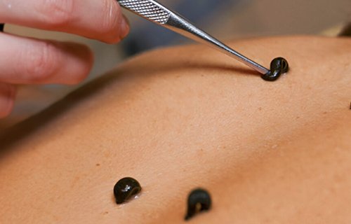 Best wellness hospital in Puthuppally